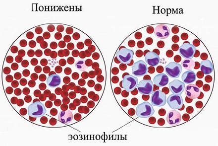 Понижены эозинофилы в крови