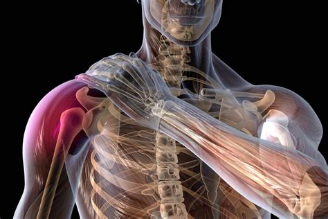 Защемление нерва в плечевом суставе симптомы и лечение
